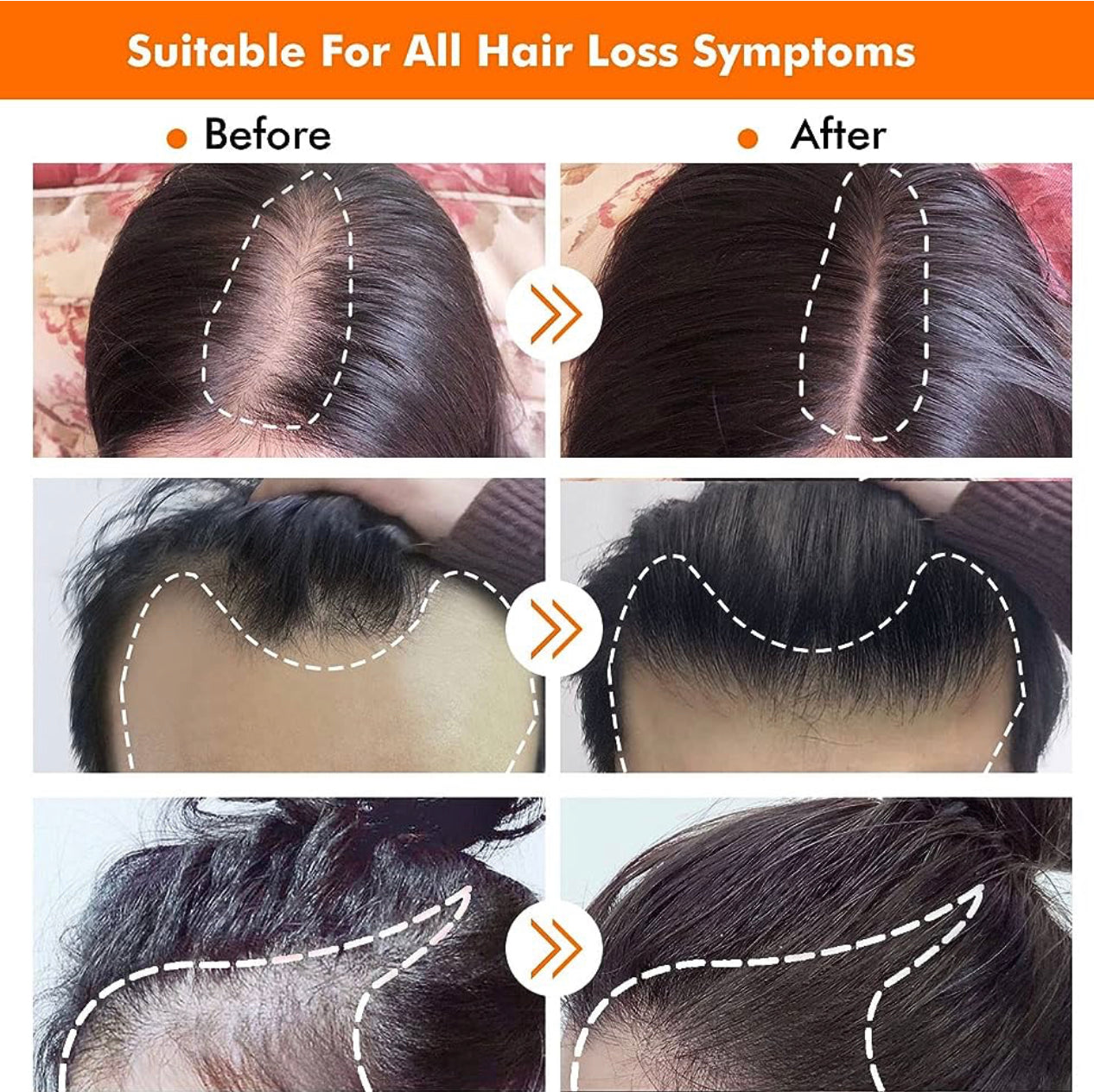 Bali ancient hair growth kit