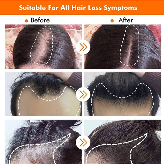 Bali ancient hair growth kit